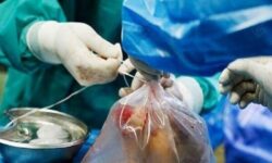 اهدای عضو در استان بوشهر جان ۶ بیمار نیازمند را نجات داد