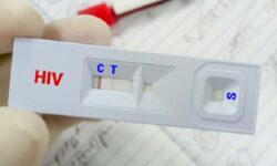 درمان «ایدز» رایگان است/ ویروس HIV قابل کنترل است به شرط درمان