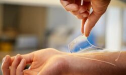 تولید زخمپوش زیستی برای بیماران دیابتی توسط رویان