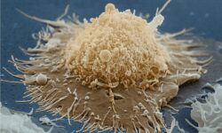 ابداع هوش مصنوعی تشخیص دهنده دیابت، اچ‌آی‌وی و کرونا از نمونه خون