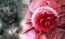 تغییر شرایط ادراری؛ مهم‌ترین علامت سرطان پروستات