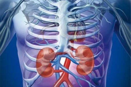 یک عامل اصلیِ بیماری مزمن کلیه